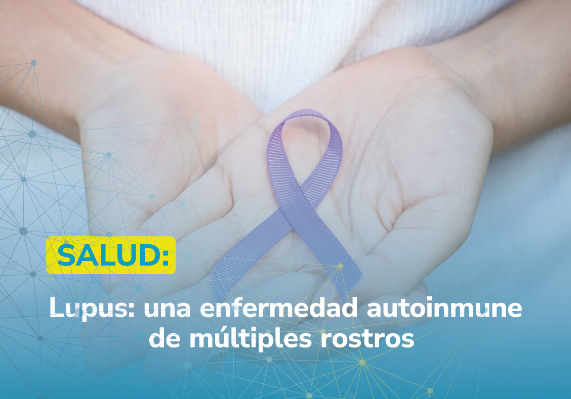 LUPUS: UNA ENFERMEDAD AUTOINMUNE DE MÚLTIPLES ROSTROS