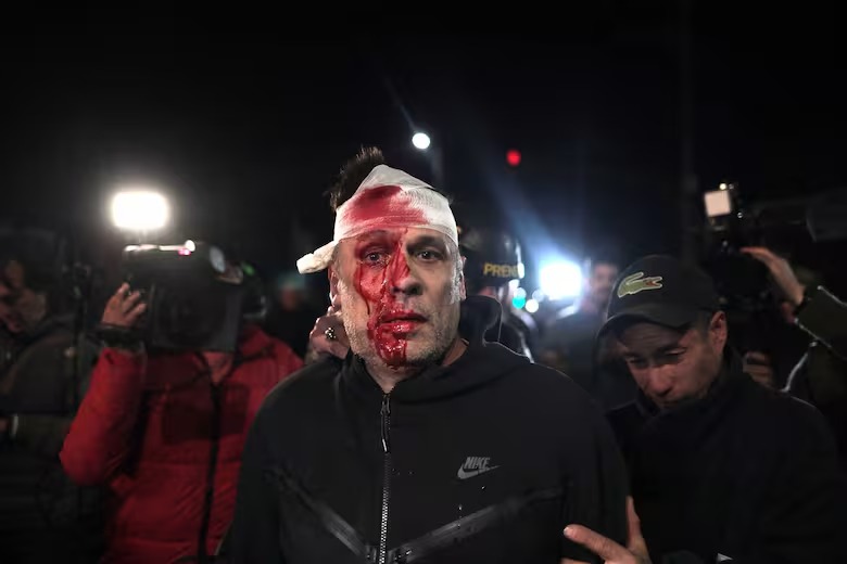 REPUDIAMOS LA AGRESIÓN A CRISTIAN MERCATANTE EN EL ACTO DE LA LIBERTAD AVANZA 