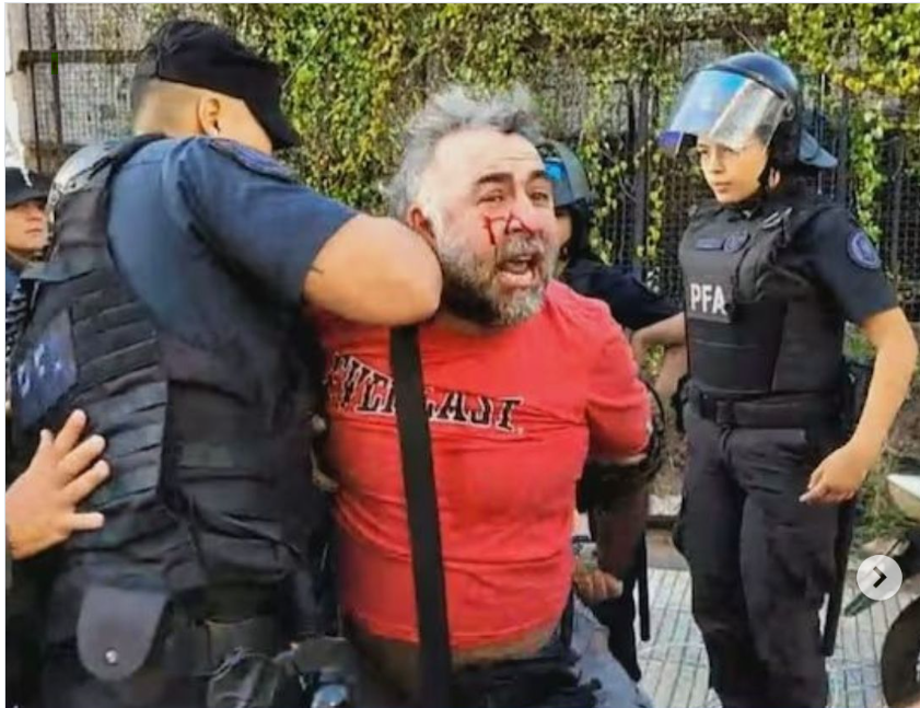 BRUTAL AGRESIÓN DE LA POLICÍA FEDERAL A TRABAJADORES DE A24